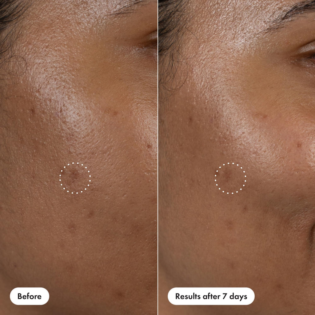 Hero Cosmetics Dark Spot Correct – 15% Vitamin C + Hyaluronic Acid Serum