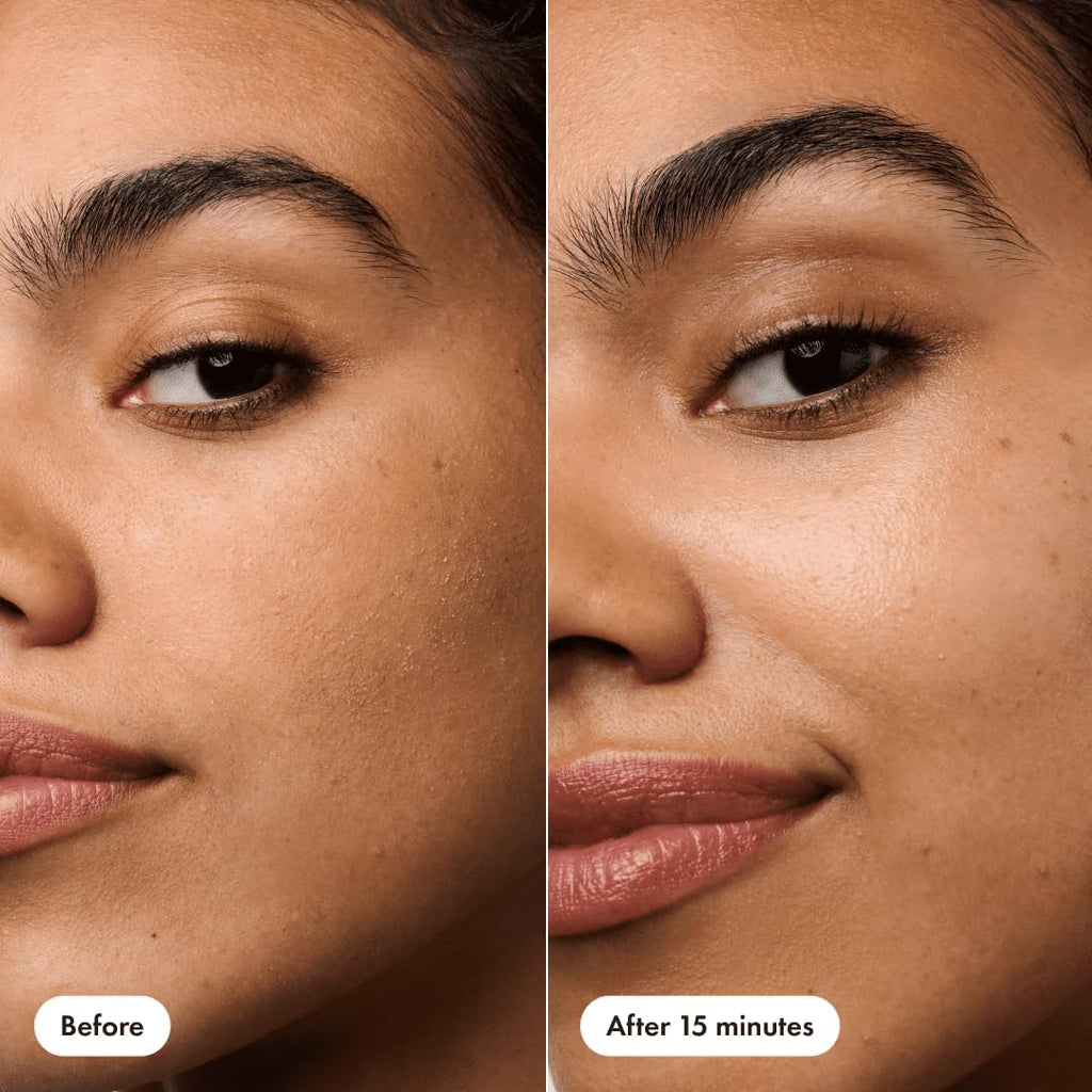 HERO COSMETICS Rescue Patch – Moisturizing Cream Patch for Post-Blemish Skin | Instant Moisture & 24h Hydration | Dermatologist-Tested