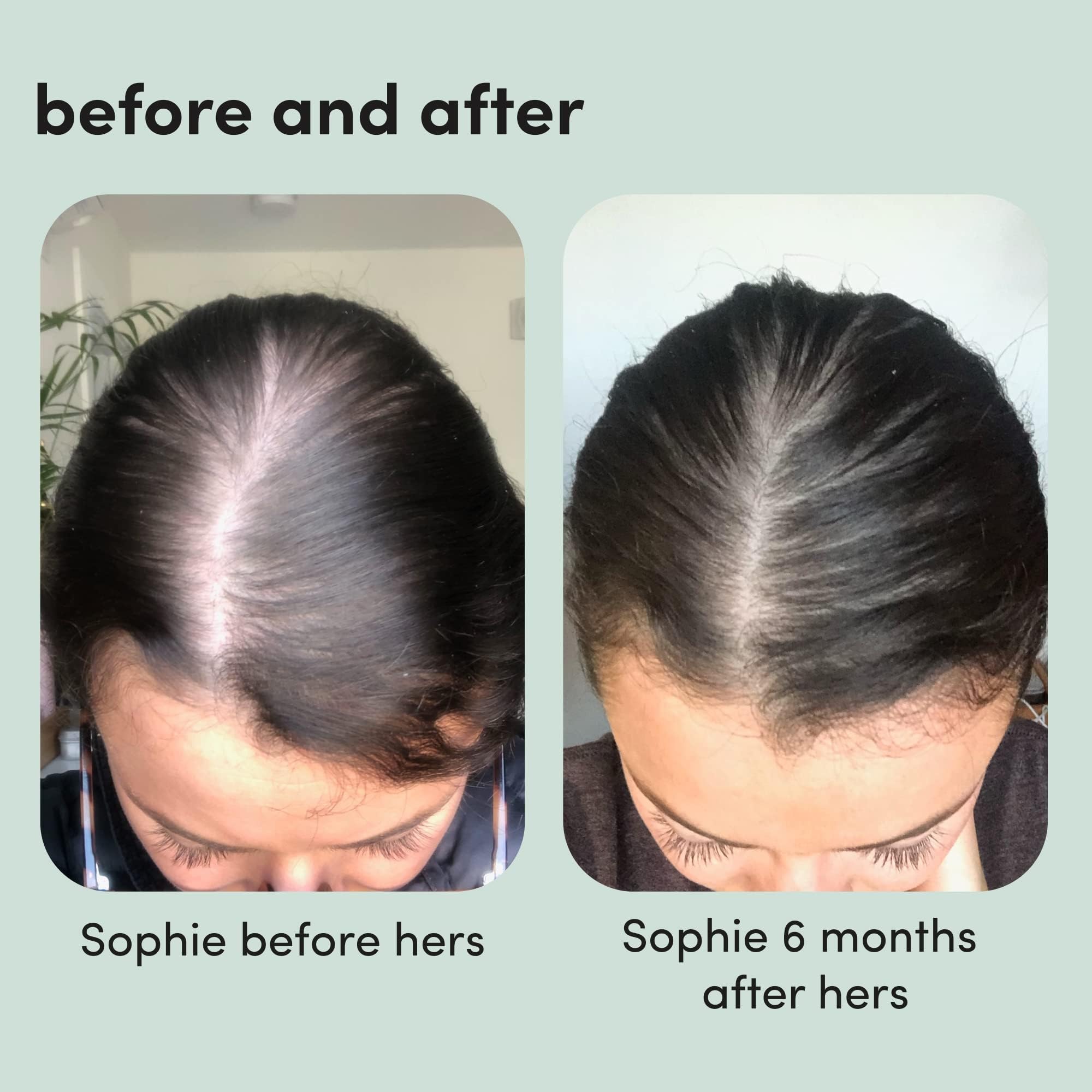 hers Hair Regrowth Foam 5% for Women — Extra Strength, Non-Greasy, Unscented | 2 Pack