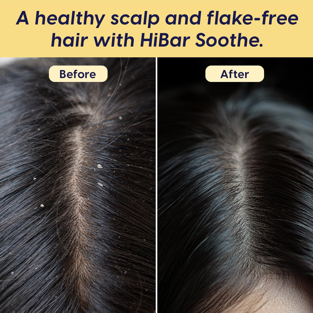 HIBAR Soothe Shampoo Bar – Dry, Itchy Scalp Relief, Plastic-Free