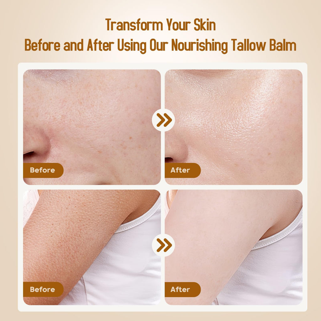Hicream Beef Tallow Balm | 100% Organic Grass-Fed Moisturizer for Dry Skin
