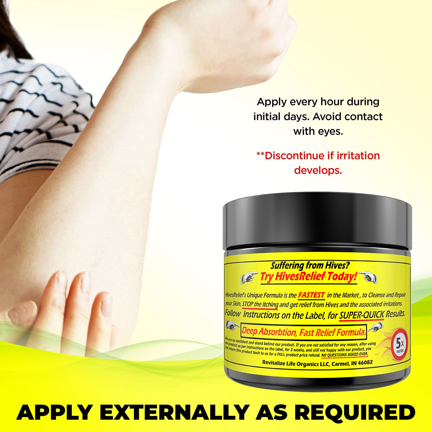 HivesRelief Cream – Fast-Acting Natural Hives Relief