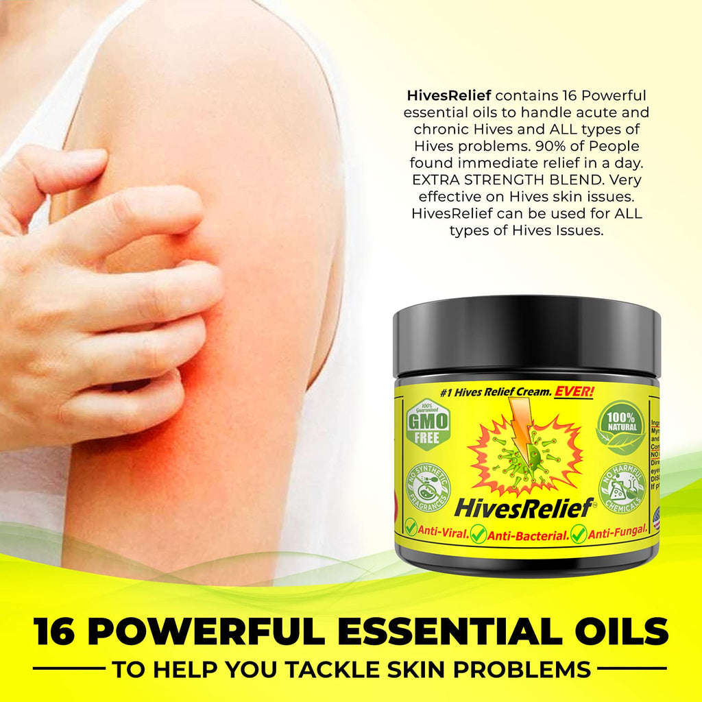 HivesRelief Cream – Fast-Acting Natural Hives Relief