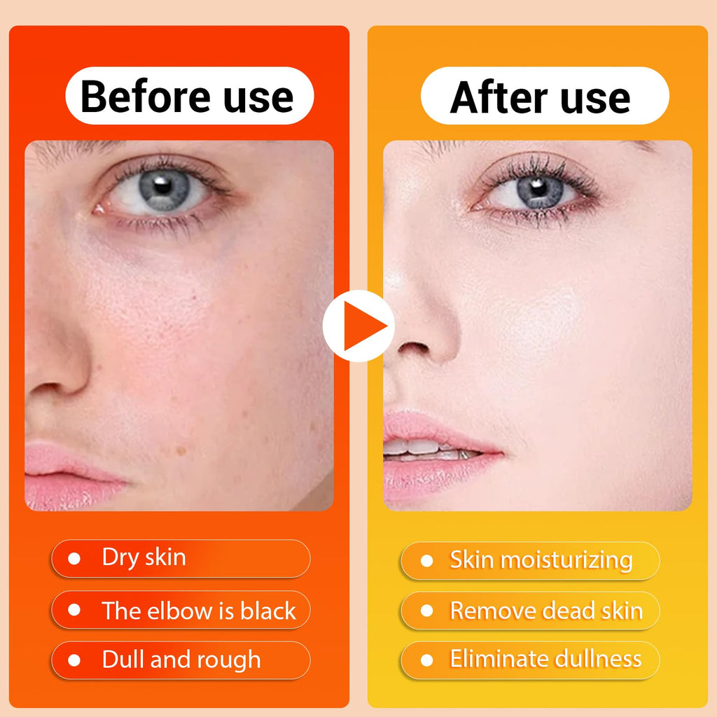 HONGYUNDA Peel Shot Keratin Care Spray — Turmeric Kojic Acid Exfoliating Spray with Retinol, Glutathione