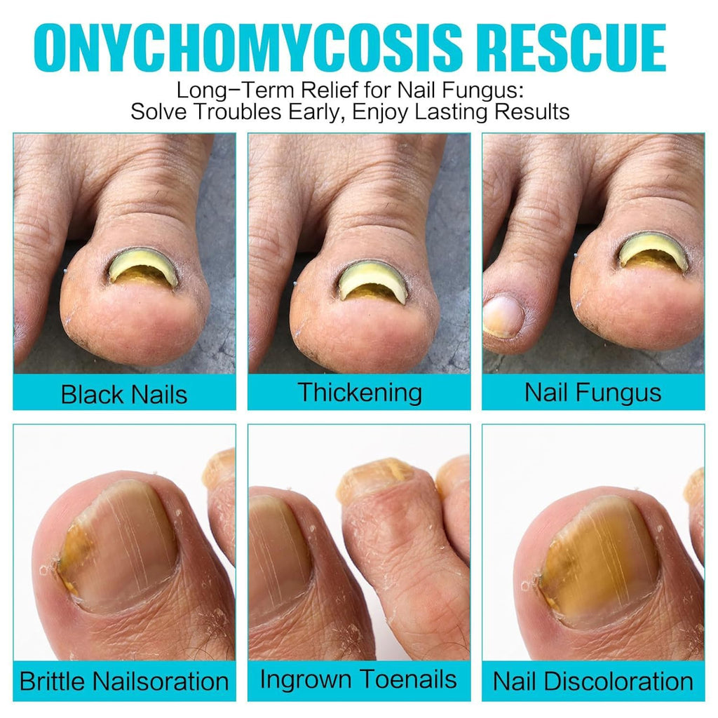 HQCC Fungal Nail Patches – 21-Count Professional Nail Care Solution