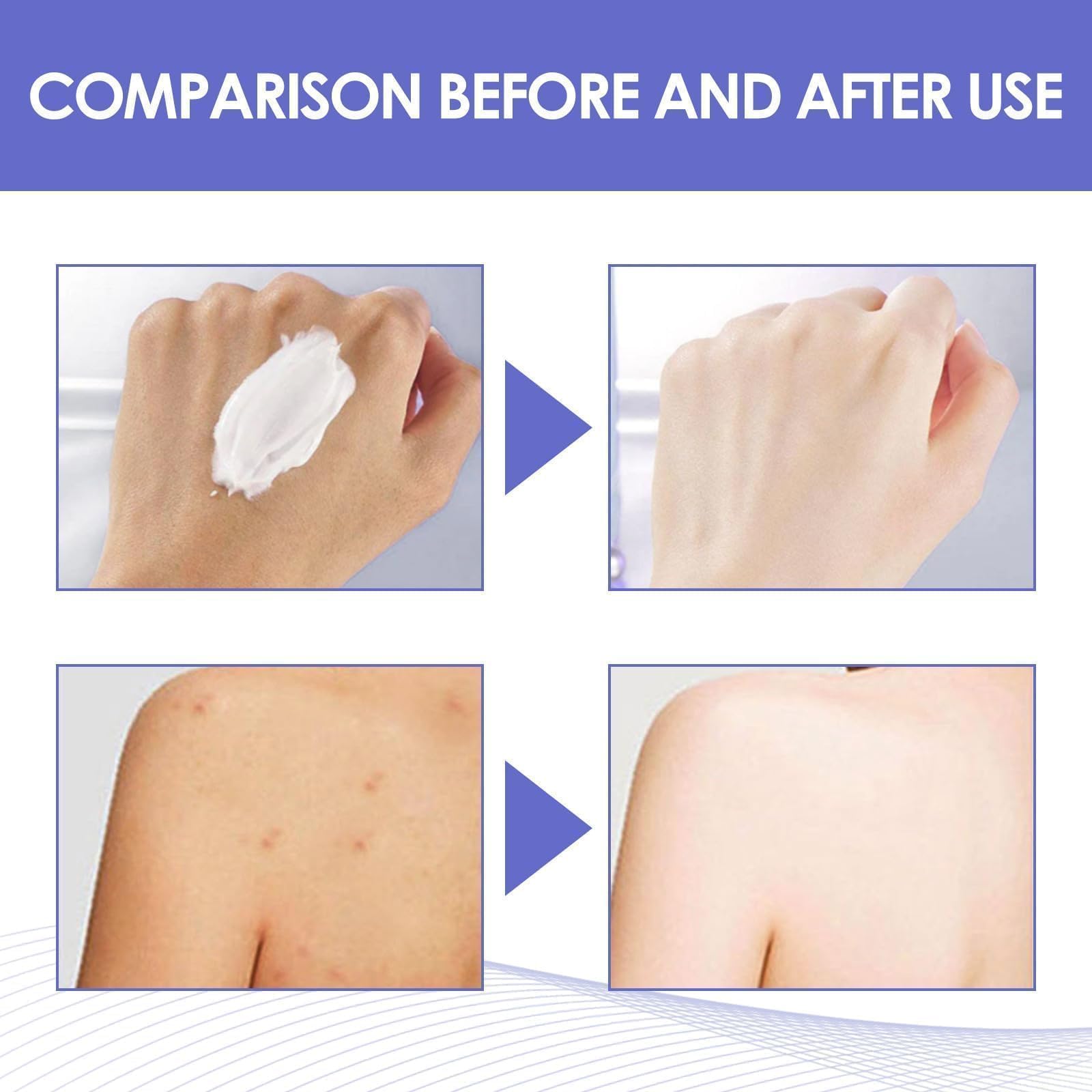 Intimate Area Brightening Cream – Underarms & Sensitive Zones (30ml x2)