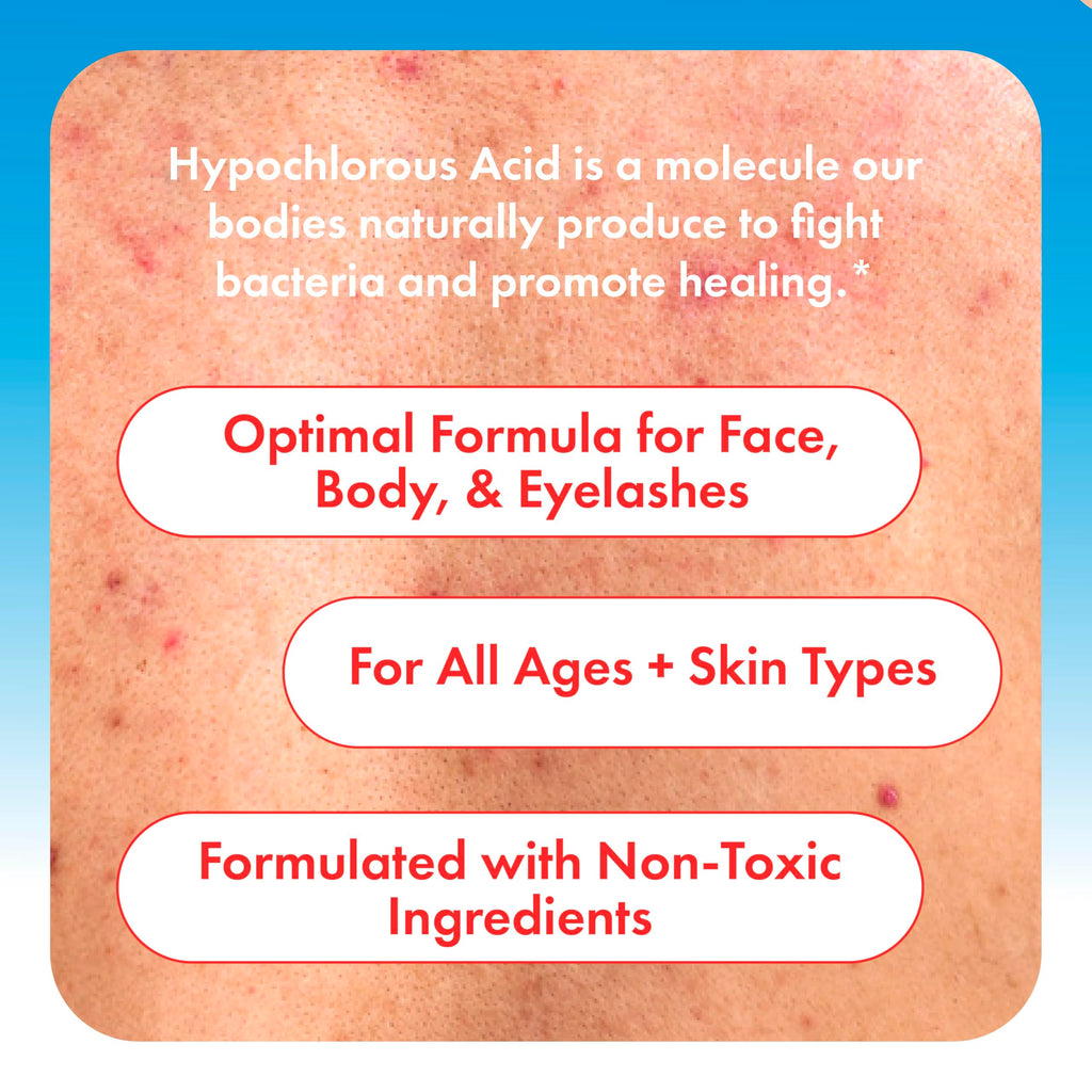 HypoClear Hypochlorous Acid Facial Spray – Gentle HOCl Toner & Cleanser for Face, Skin & Eyes (8 oz)