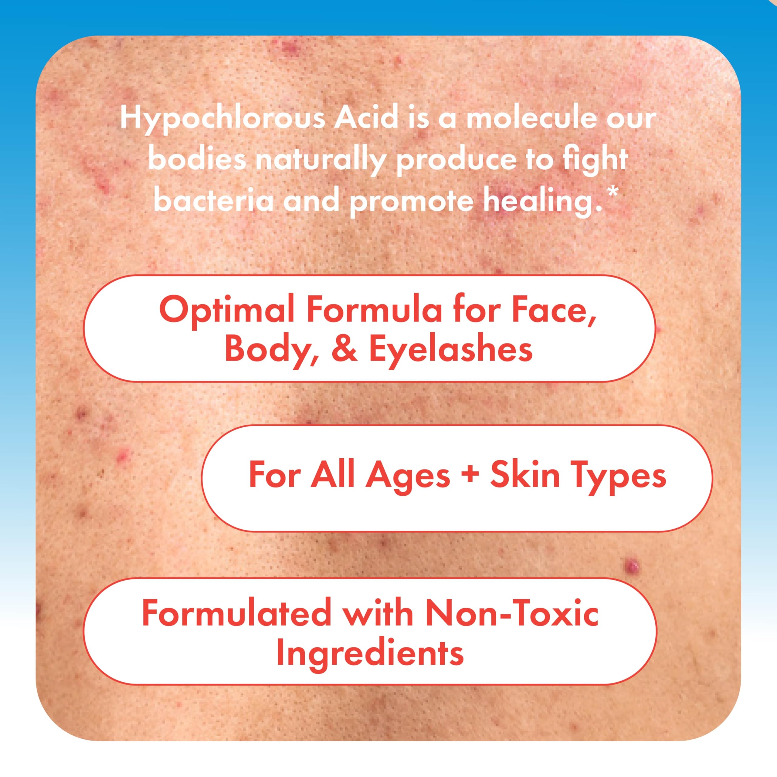 HypoClear Hypochlorous Acid Facial Spray – Gentle HOCl Toner & Cleanser for Face, Skin & Eyes (8 oz)