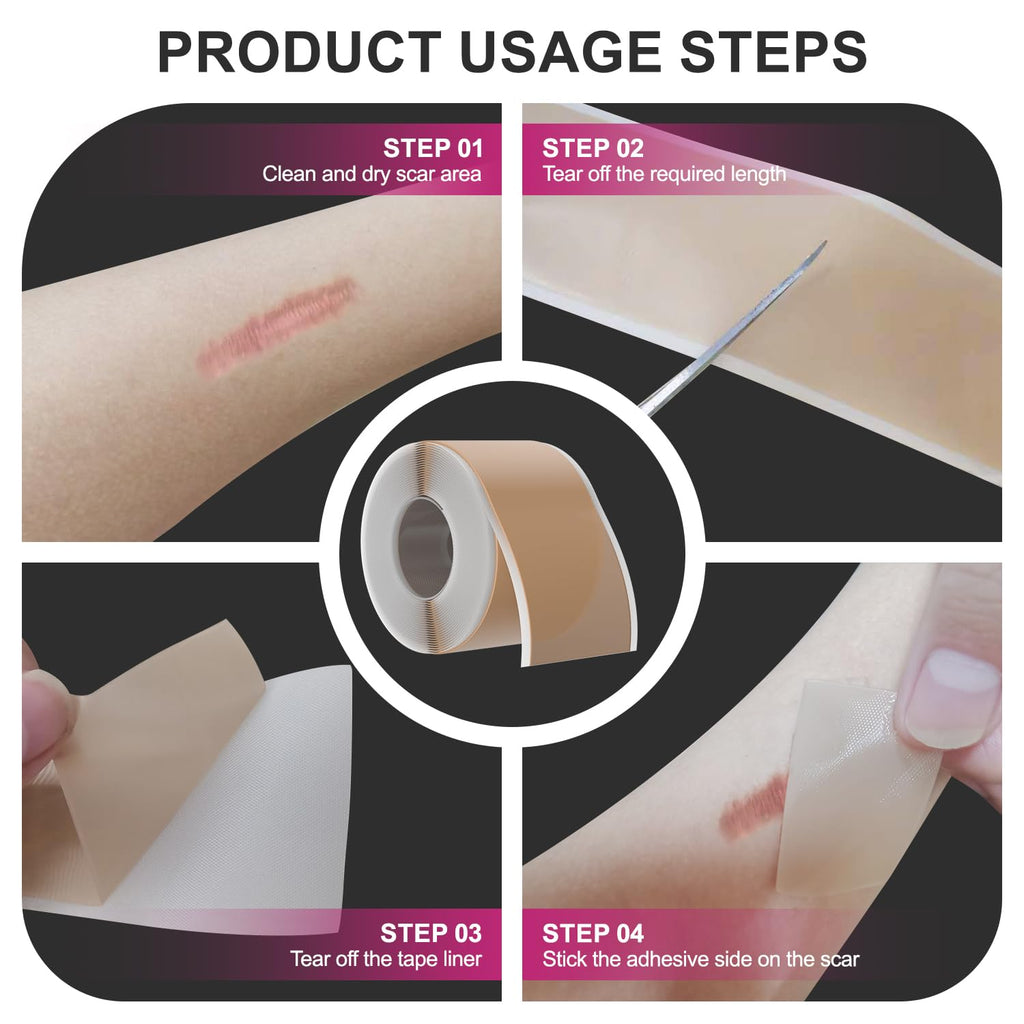 Hysimedy Silicone Scar Sheets – Medical Grade Scar Tape 4.5 cm x 120 in