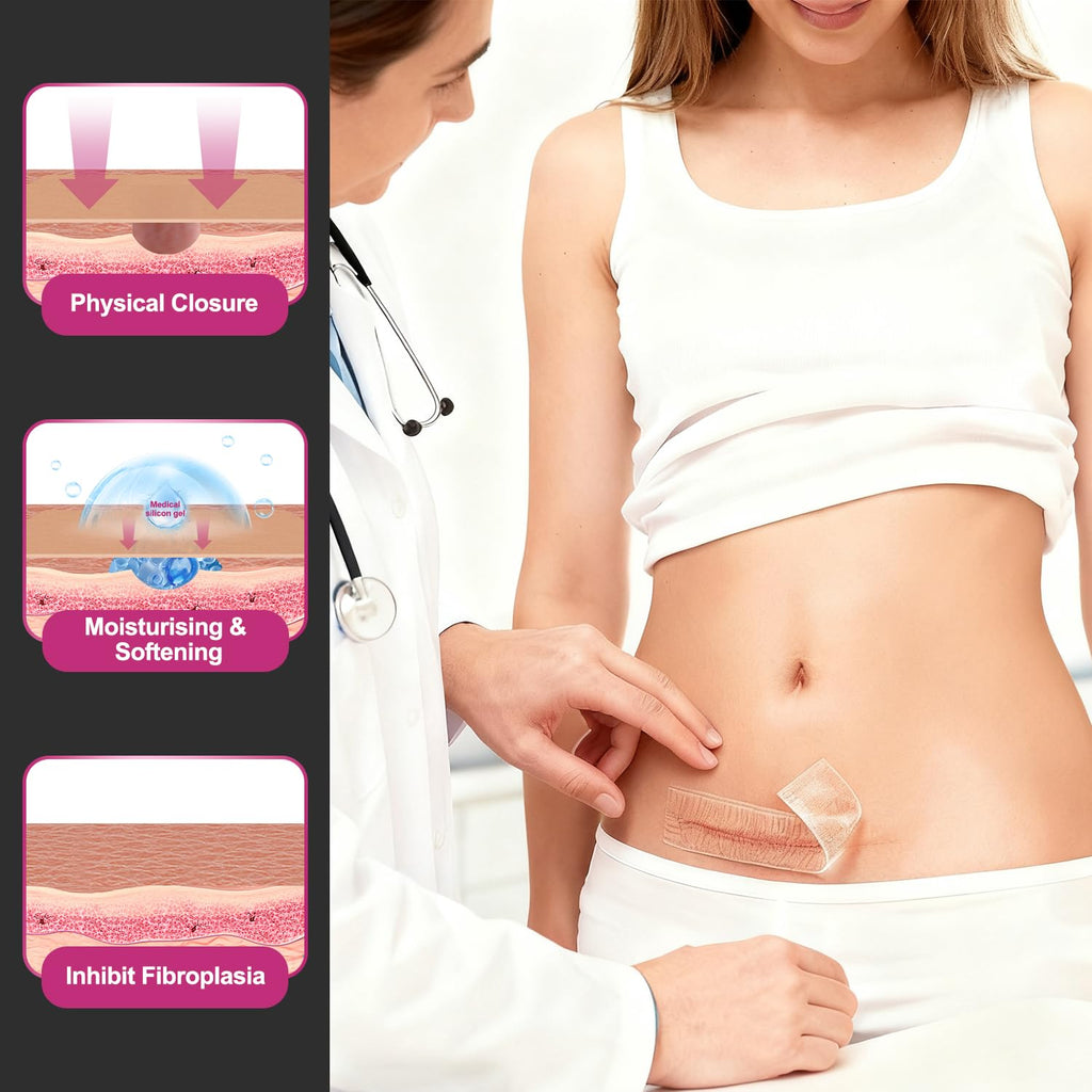 Hysimedy Silicone Scar Sheets – Medical Grade Scar Tape 4.5 cm x 120 in