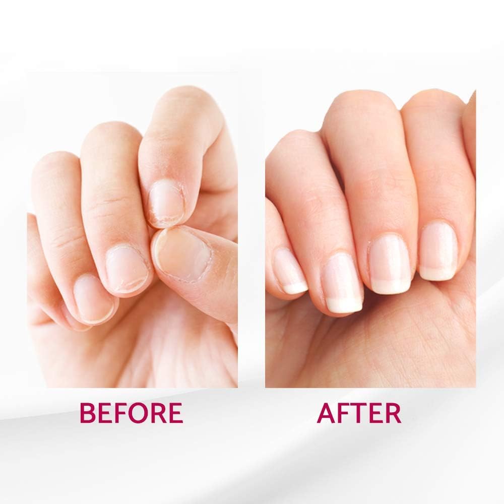 IBD Reconstrux Nail Repair Treatment – Nail Strengthener & Growth Support (2 Pack) | USA Made
