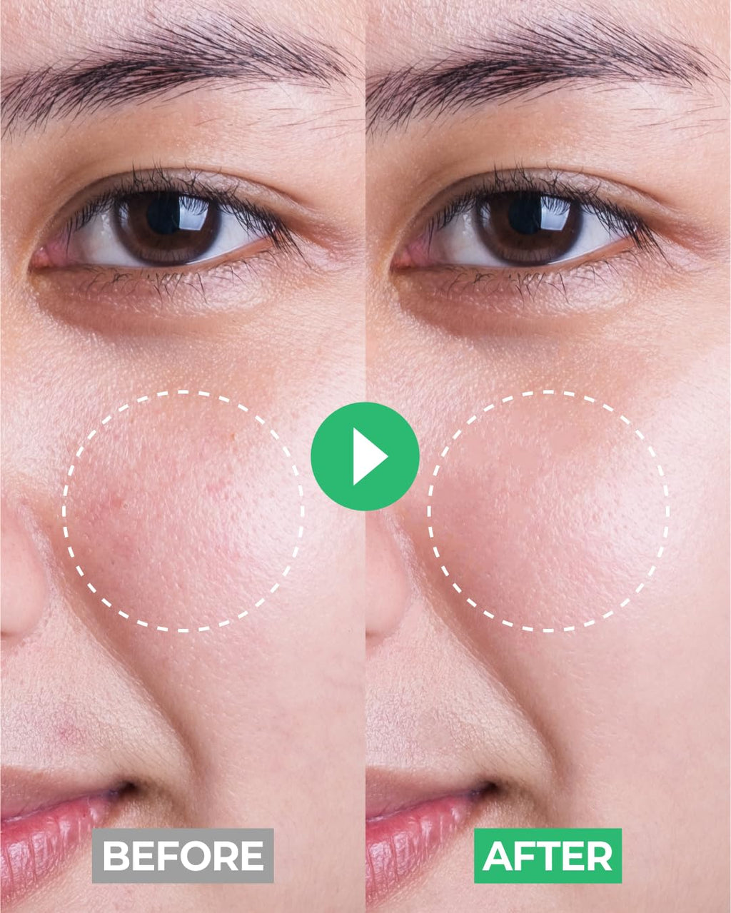 iBodle Facial Foaming Cleanser – Tear-Free, Low-Irritant Korean Skincare for Sensitive Skin