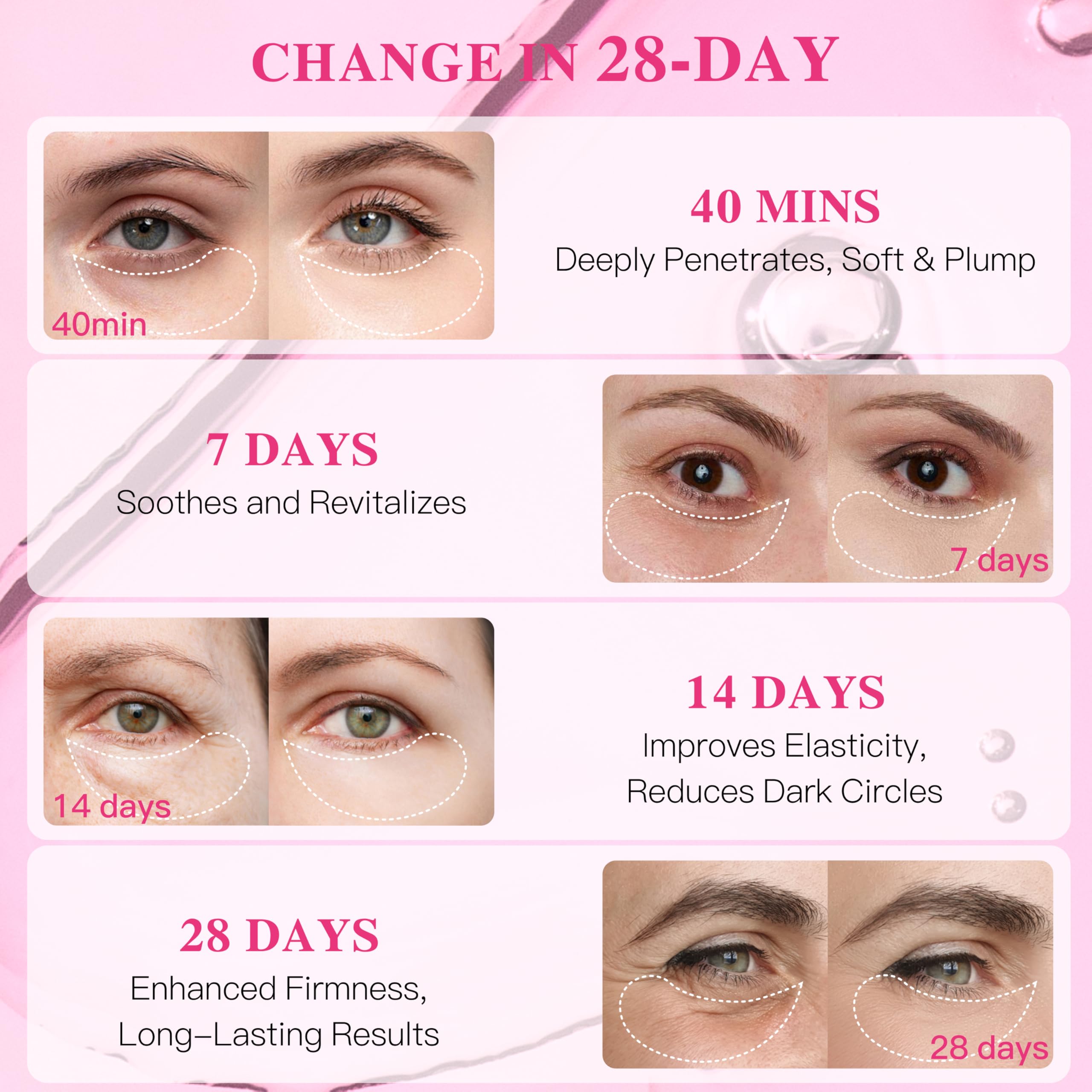 ICIKOL Under Eye Patches with Collagen – Deep Hydration Hydrogel Mask for Puffy Eyes & Dark Circles (30 Pairs)