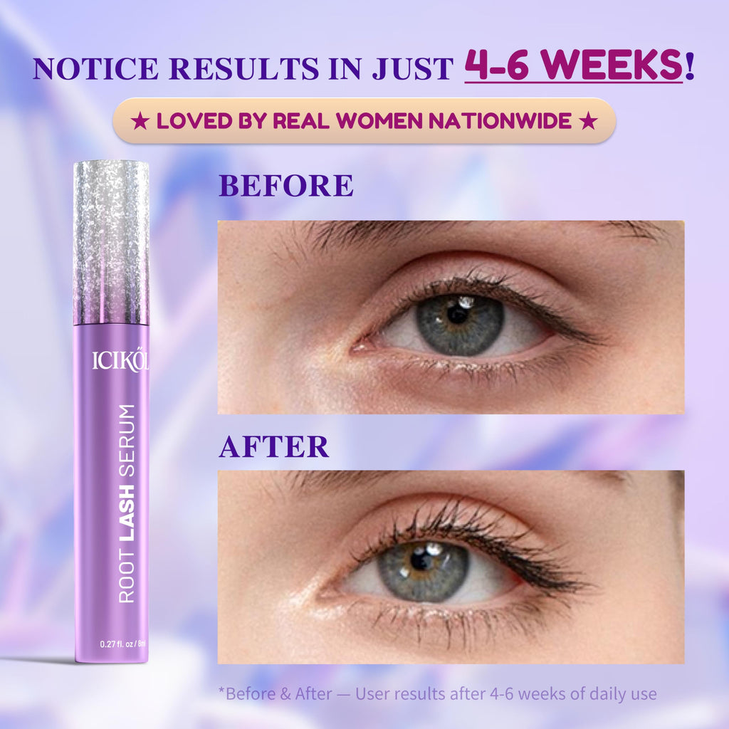 ICIKOL Eyelash Growth Serum – Peptide & Vitamin Formula, Vegan & Cruelty-Free