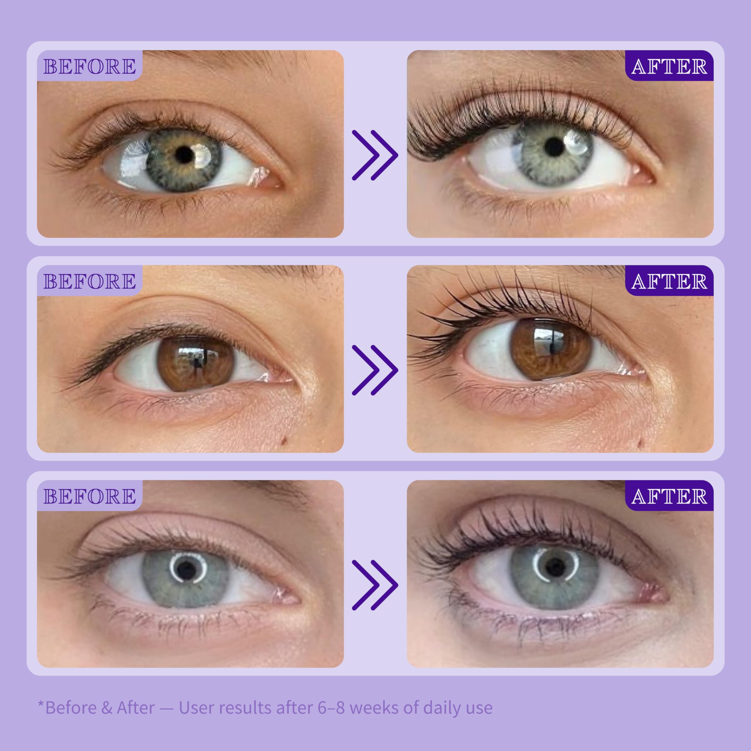 ICIKOL Lash Serum for Eyelash Growth | Advanced Peptide & Biotin Formula, Prostaglandin-Free, 16mL
