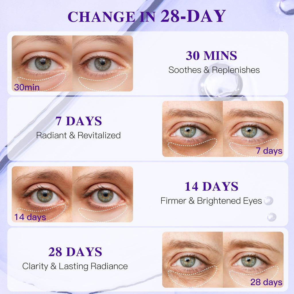 ICIKOL Collagen Under Eye Patches – Puffy Eyes & Dark Circles, Deep Hydration (12 Pairs)