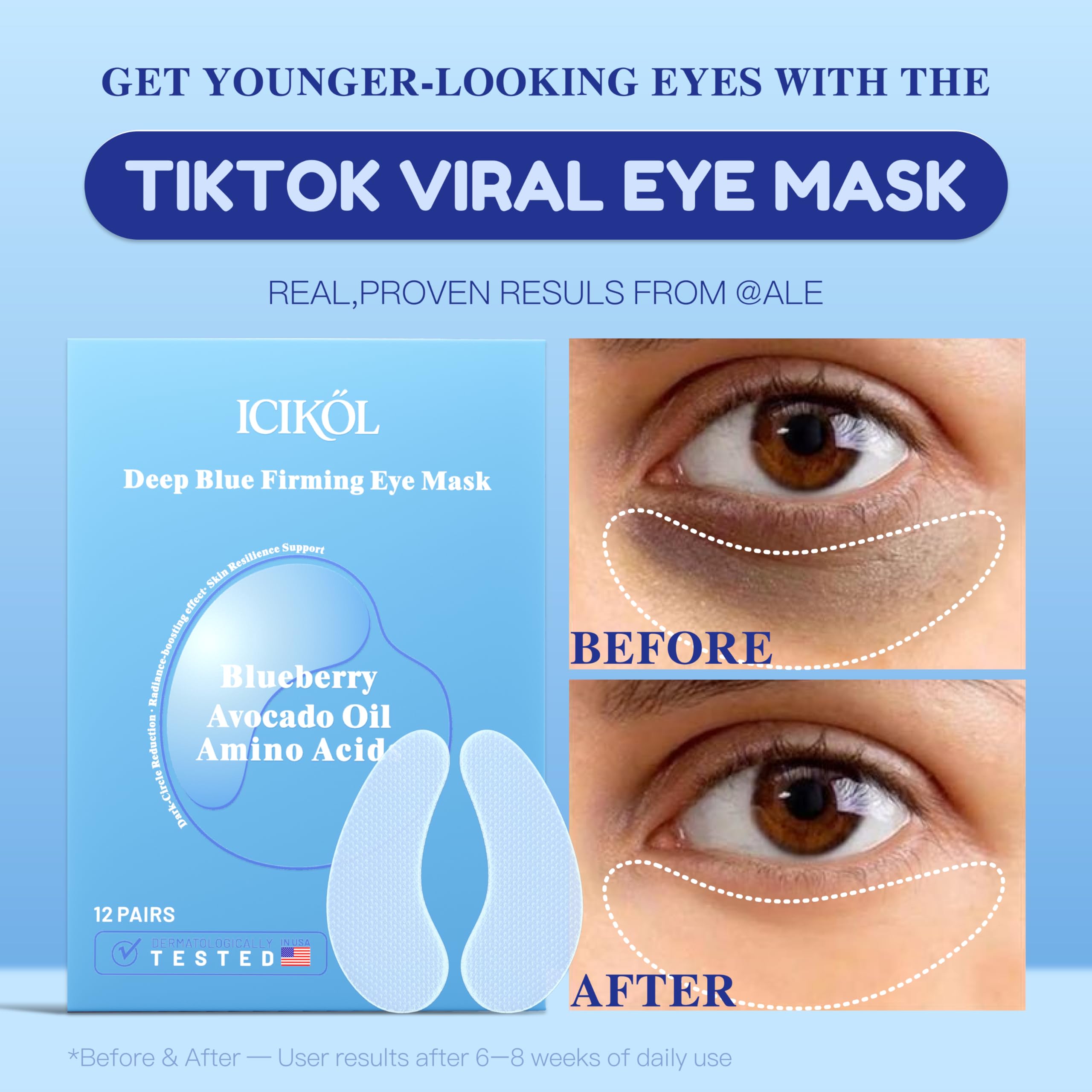 ICIKOL Under Eye Mask Blueberry – Collagen Patches (12 Pairs)