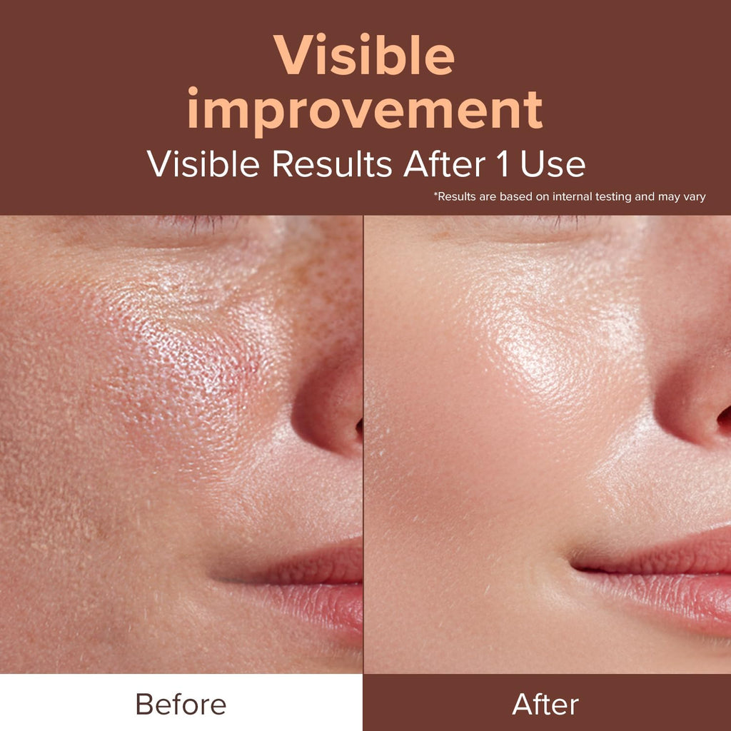 ID PLACOSMETICS Exo-V Booster Ampoule – 720,000 PPM Exosome Serum with PDRN & Glutathione