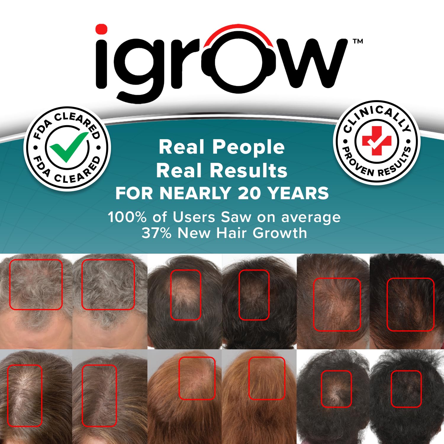 iGrow Laser Hair Growth System | FDA-Cleared Red Light Therapy Cap