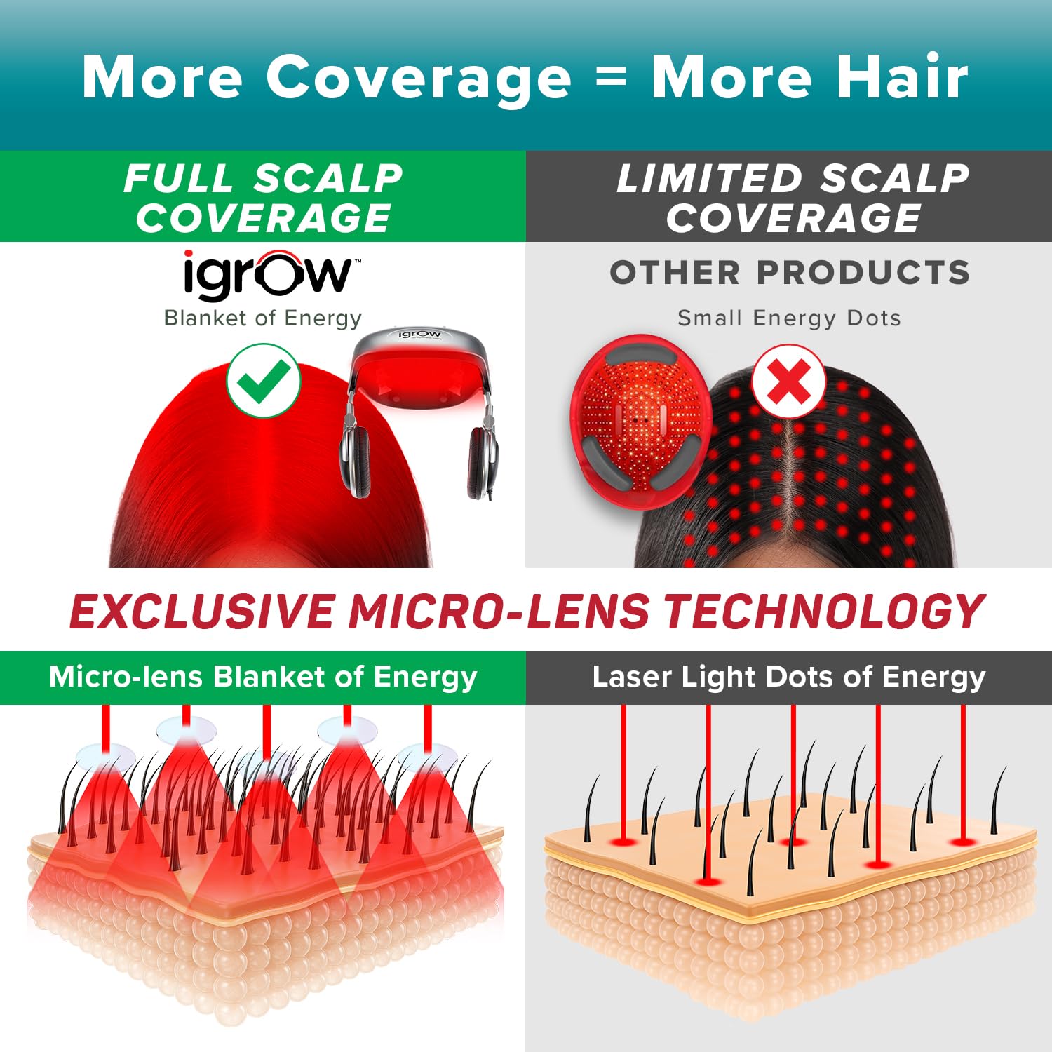 iGrow Laser Hair Growth System | FDA-Cleared Red Light Therapy Cap