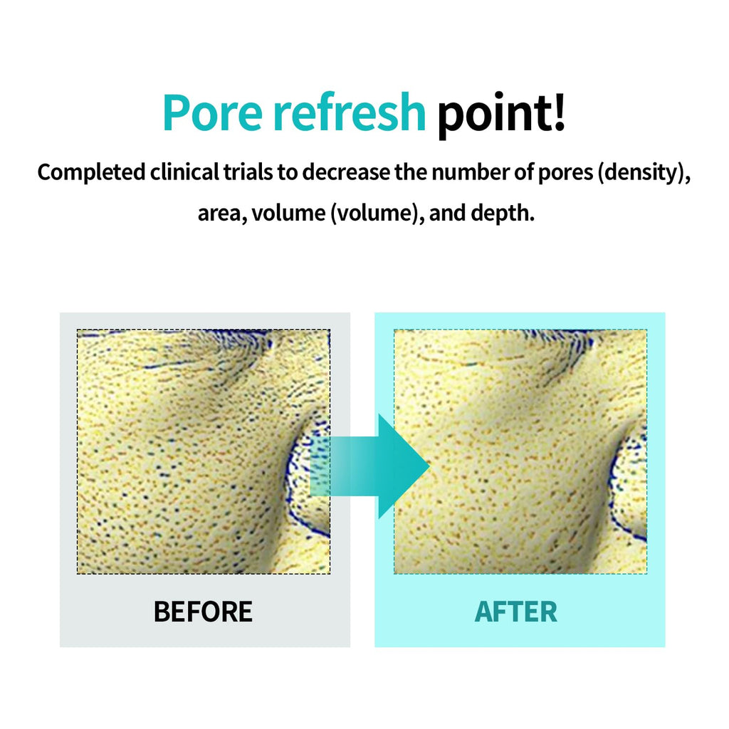 Ilso Moringa Tightening Pore Serum – 1.01 fl oz | Refine Pores & Smooth Texture