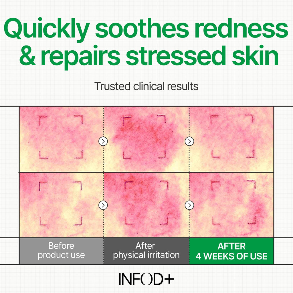 INFODPLUS Korean Skin Care Sensitive Face Cream – Lightweight Ceramides & Panthenol Moisturizer (50ml)