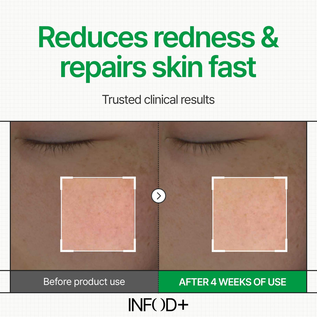 INFODPLUS Korean Skin Care Sensitive Face Cream – Lightweight Ceramides & Panthenol Moisturizer (50ml)
