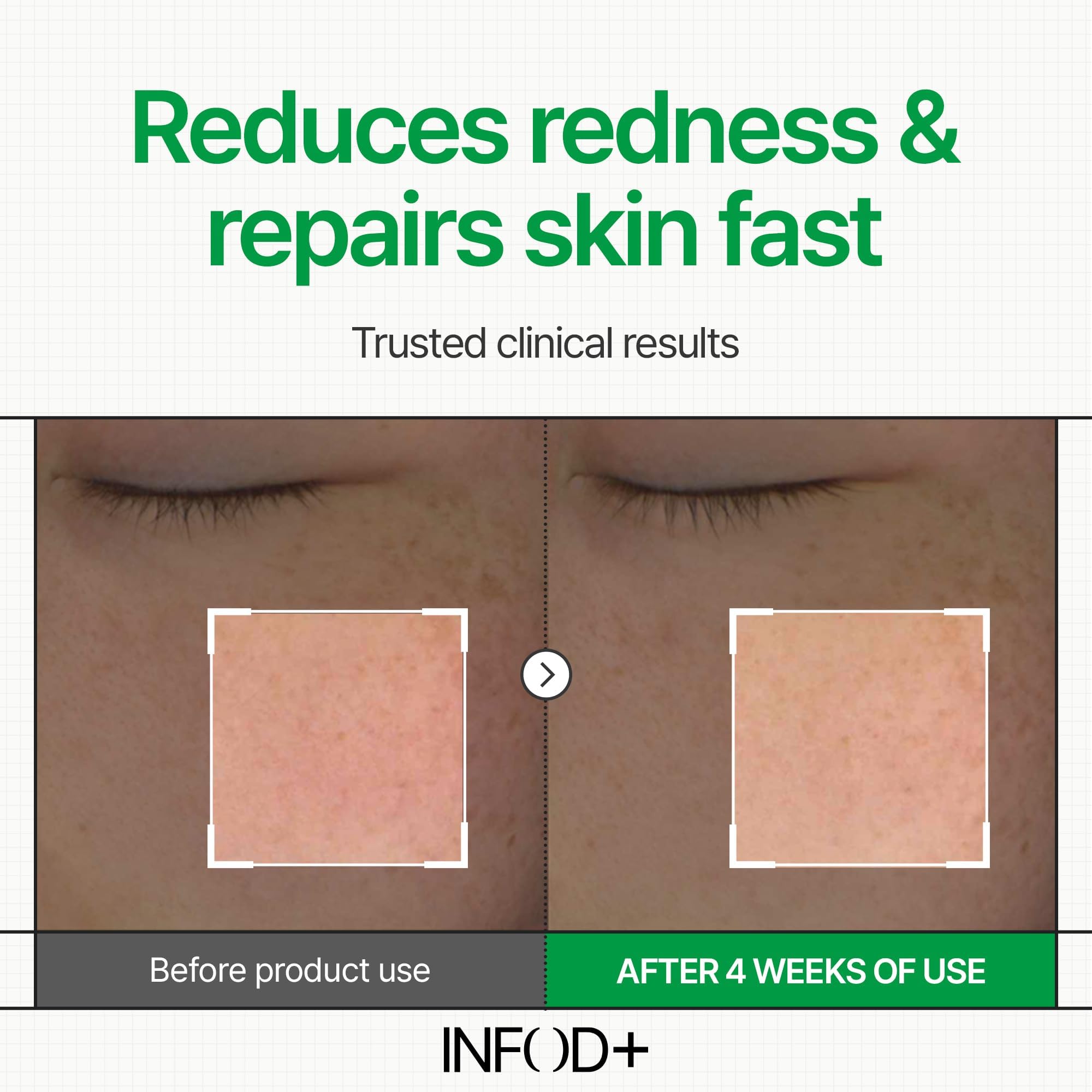 INFODPLUS Korean Skin Care Sensitive Face Cream – Lightweight Ceramides & Panthenol Moisturizer (50ml)