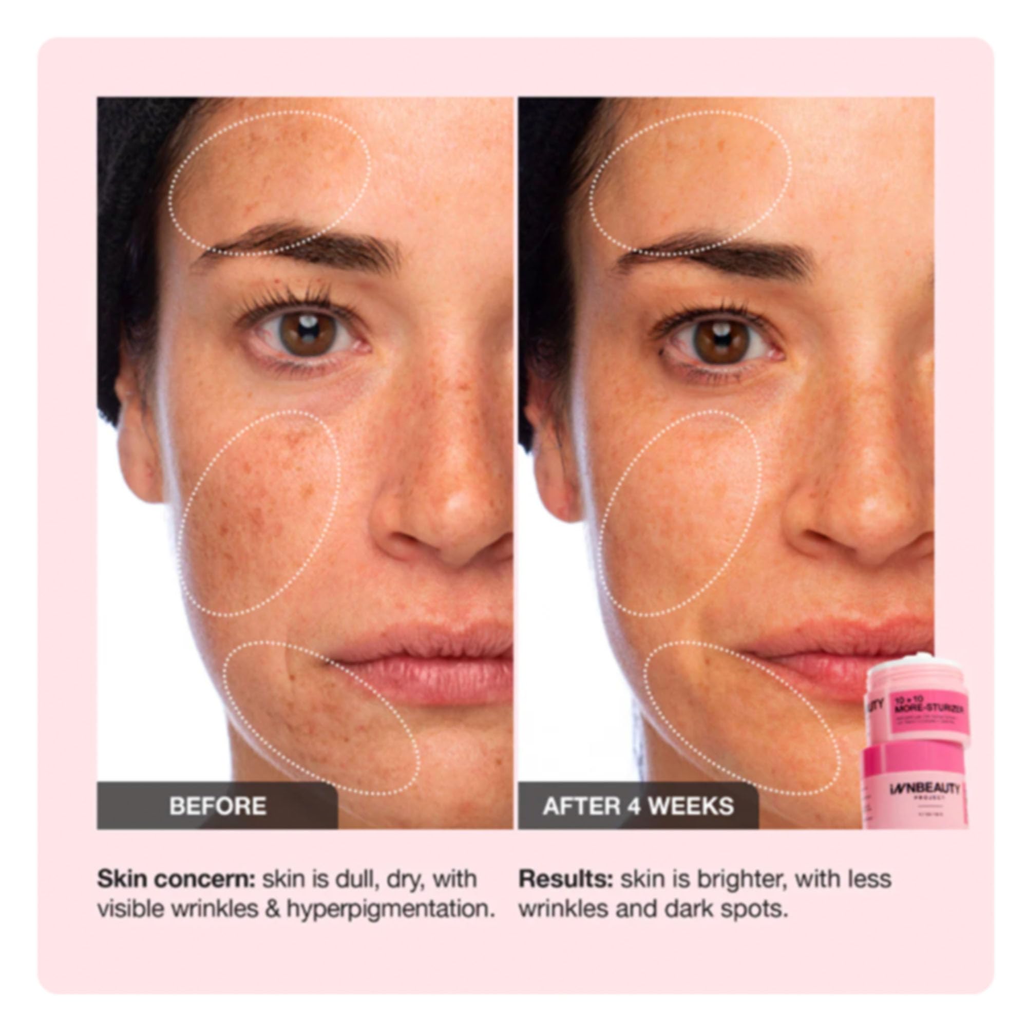 Innbeauty Project 10+10 Daily Moisturizer — Vitamin C + Peptides + Ceramides