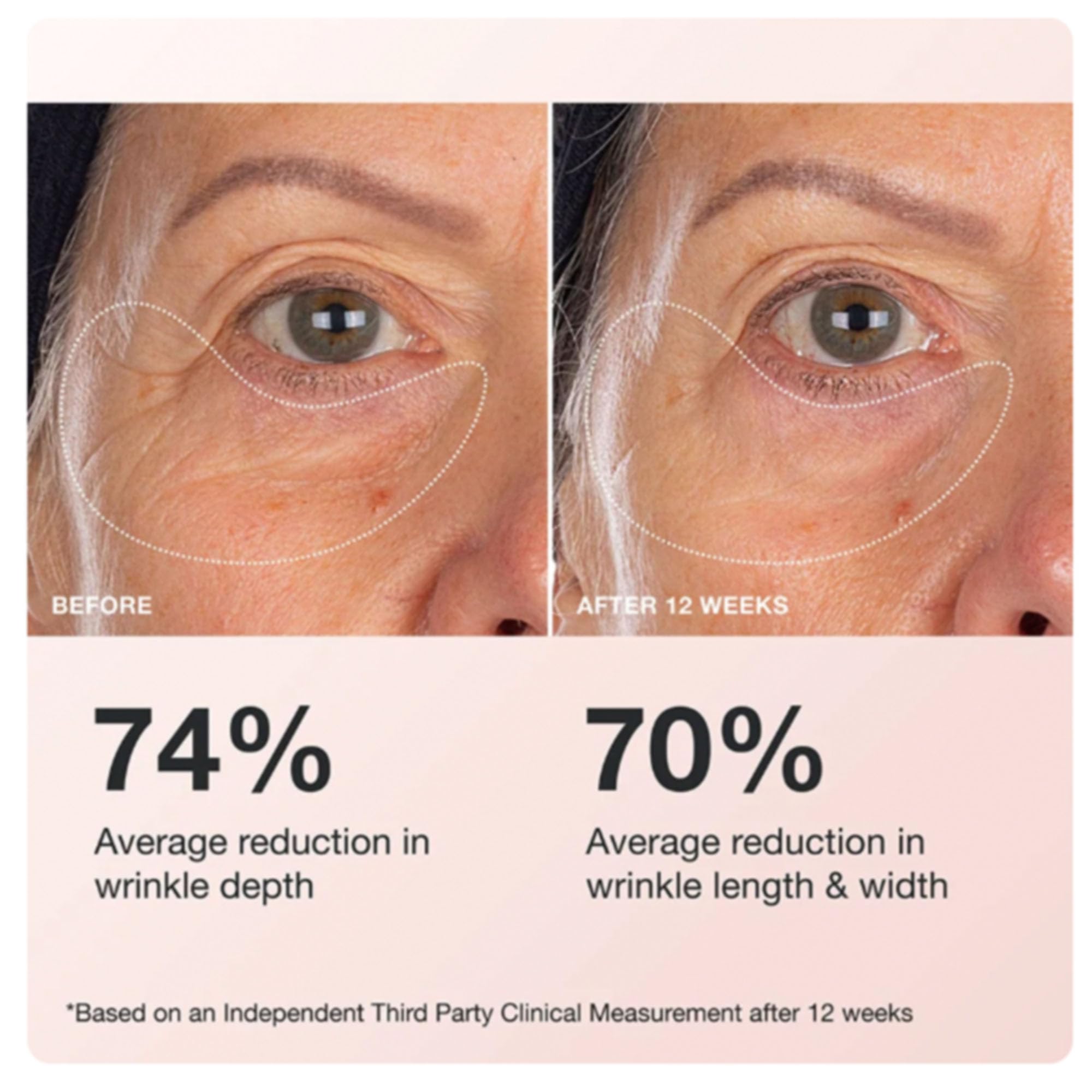 Innbeauty Project Extreme Cream Eye Firming and Contouring—Refillable 0.5 oz with Peptides and Botanicals