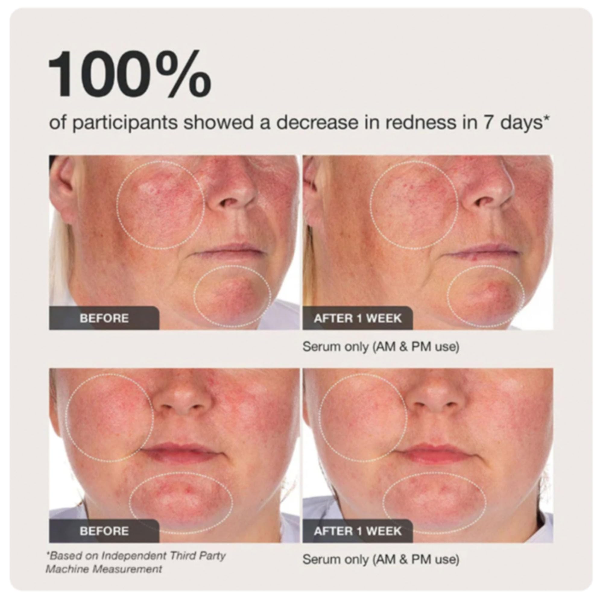 Innbeauty Project Calm the Red Down Dual Chamber Serum – Redness Relief & Barrier Support | 1.7 oz