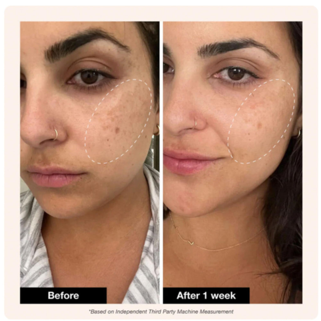 Innbeauty Project Retinol Remix 1% Serum with Peptides & Tranexamic Acid - 1 oz
