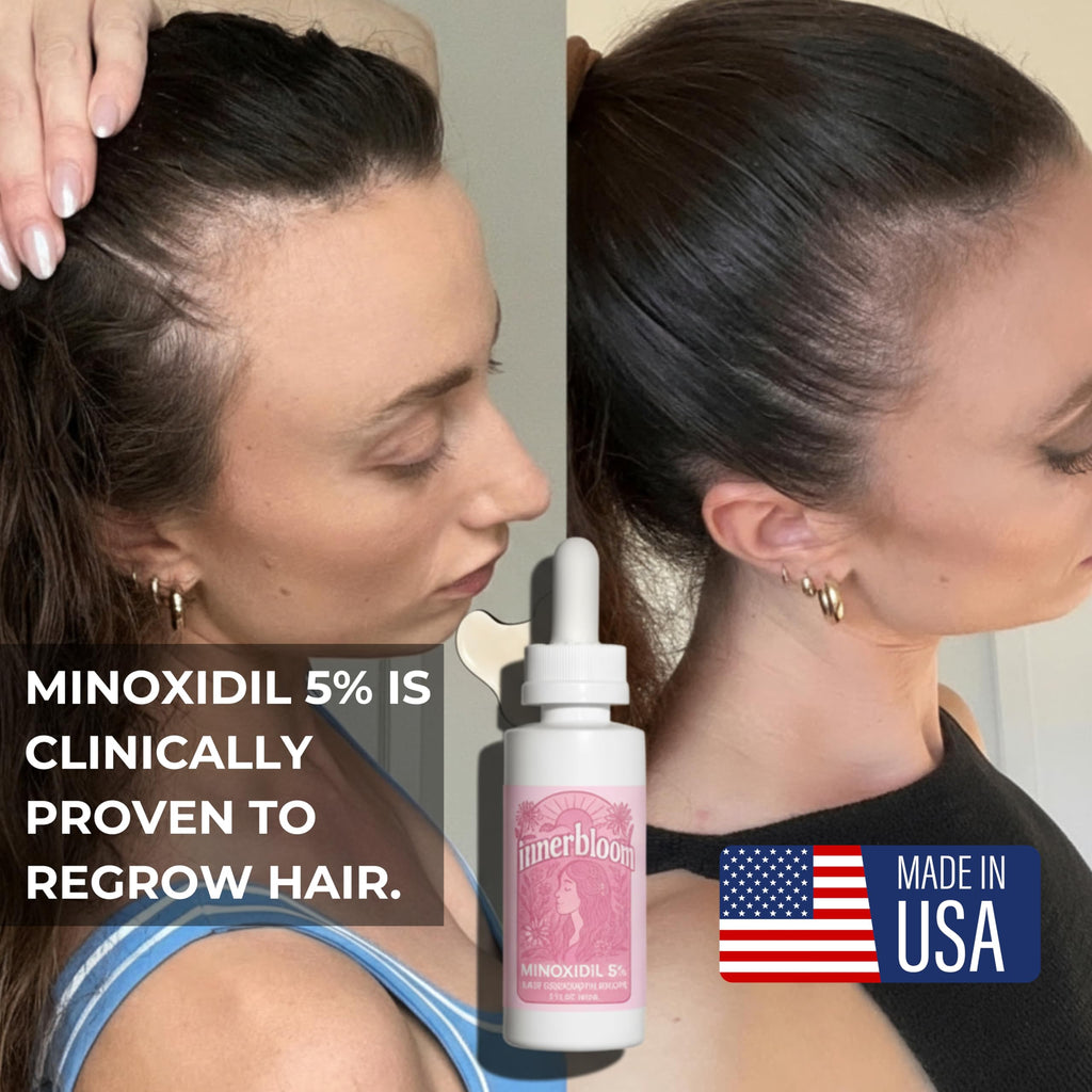 Innerbloom Made in USA 5% Minoxidil for Women – Hair Growth Drops (1 Pack)