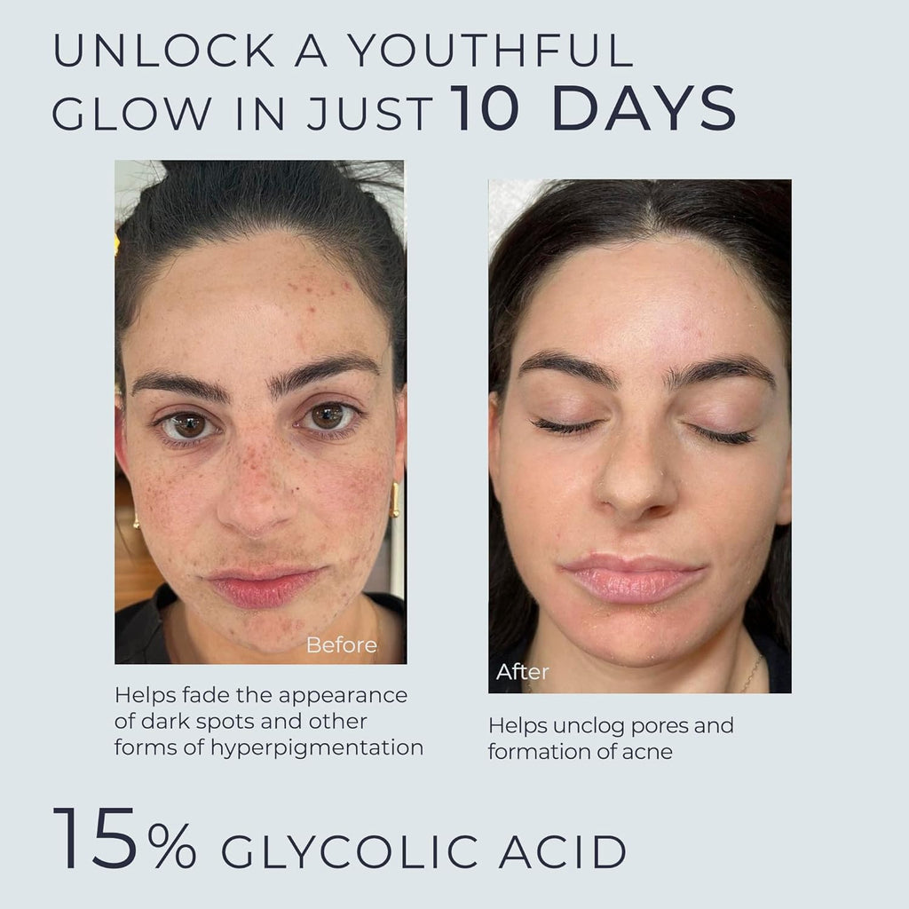 InstaSkincare Glycolic Acid Serum 15% – Extra Large 8oz for Radiant Skin