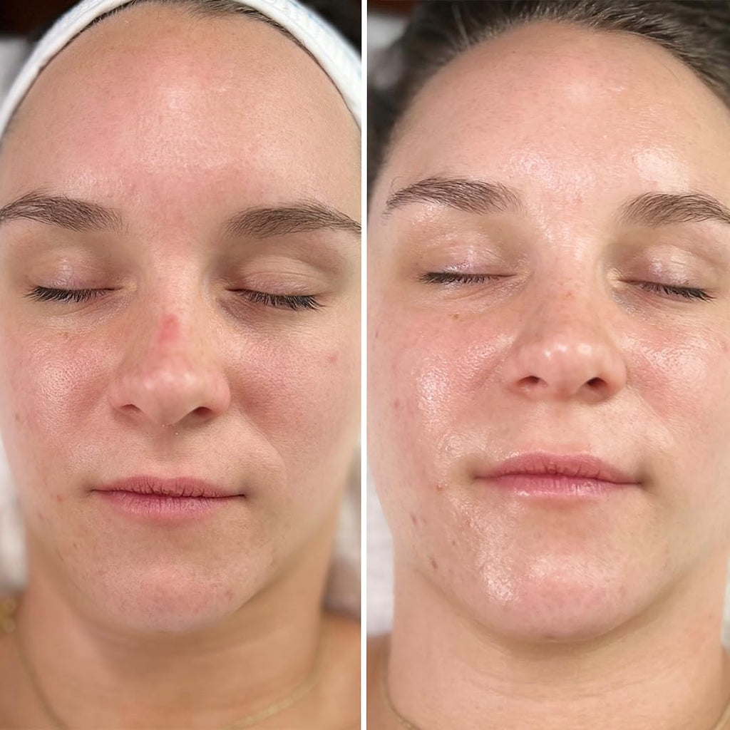 Intraceuticals Rejuvenate Daily Serum – Deep Hydration, Radiance & Makeup Prep