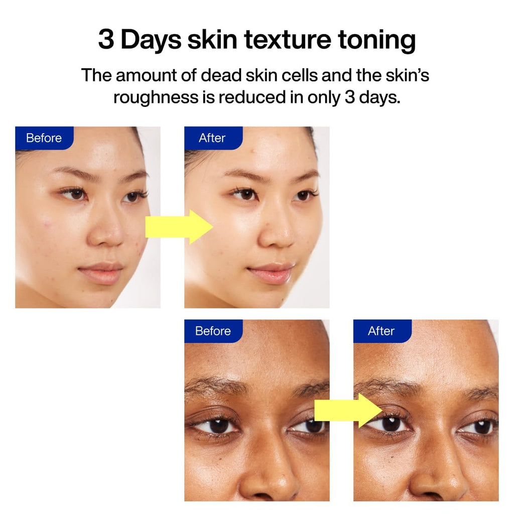 IOPE Gluta Vitamin C Brightening Serum | 25% Pure Vitamin C + 1000ppm Glutathione for Radiant Skin