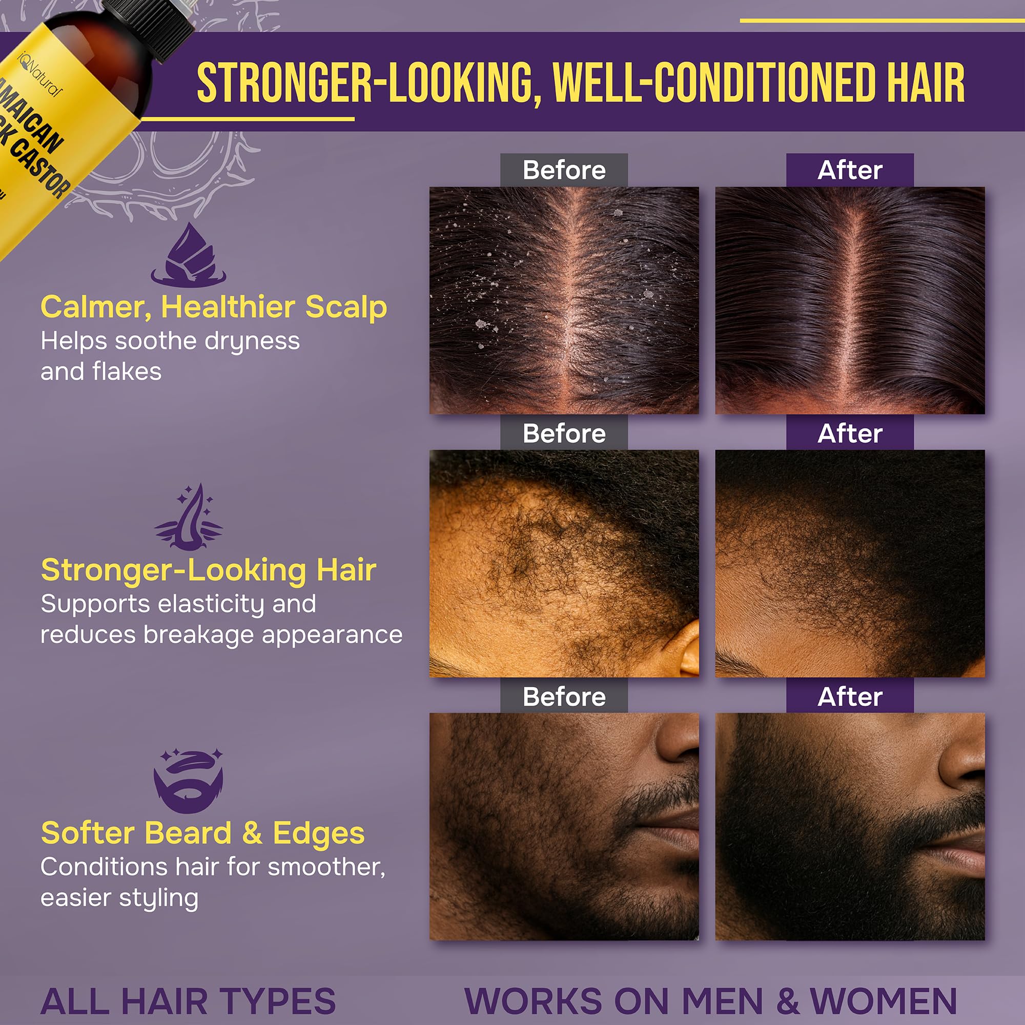 IQ Natural Jamaican Black Castor Oil - 2 Pack Unscented 4oz | Hair Conditioning & Skin Care