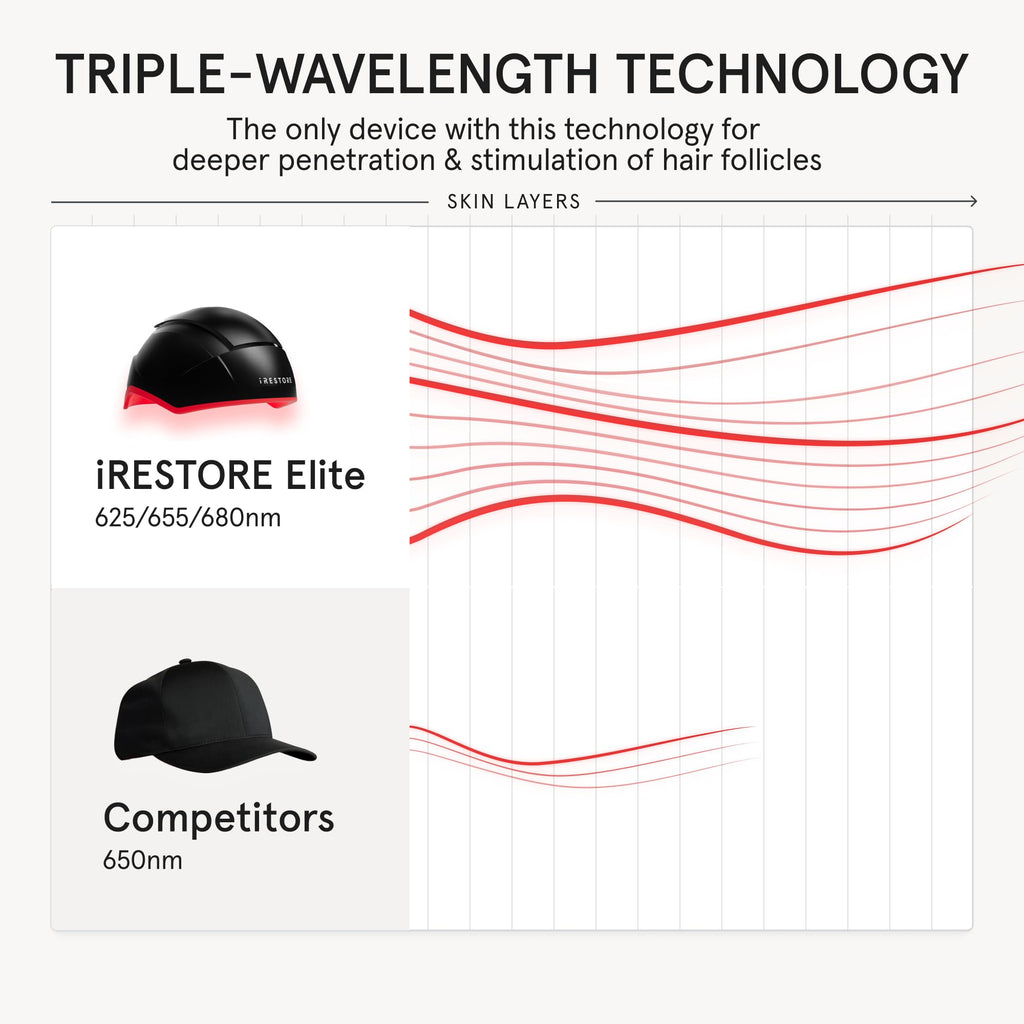 iRestore Elite Laser Hair Growth System – FDA-Cleared Home Treatment with 500 Lasers & LEDs