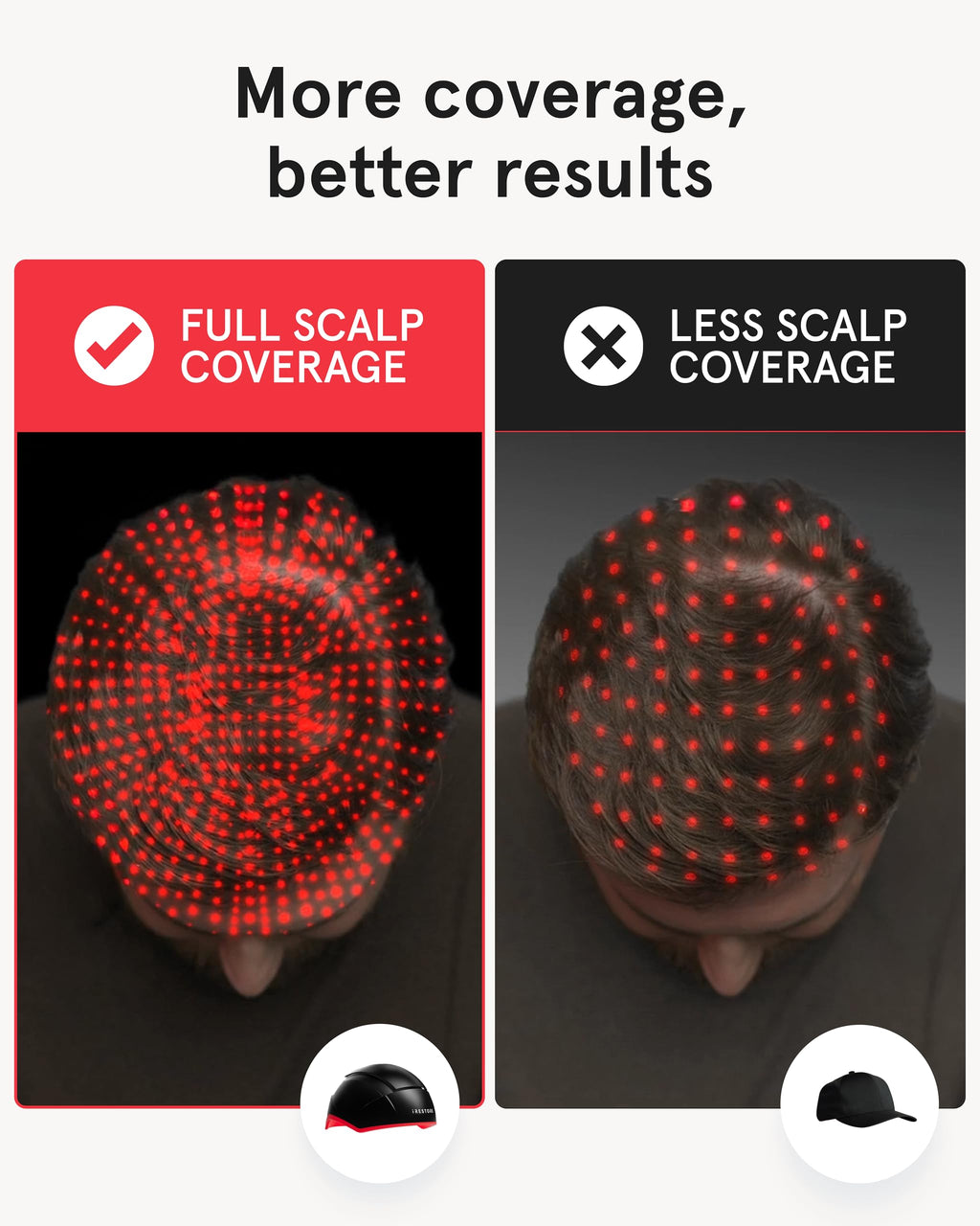 iRestore Elite Laser Hair Growth System – FDA-Cleared Home Treatment with 500 Lasers & LEDs