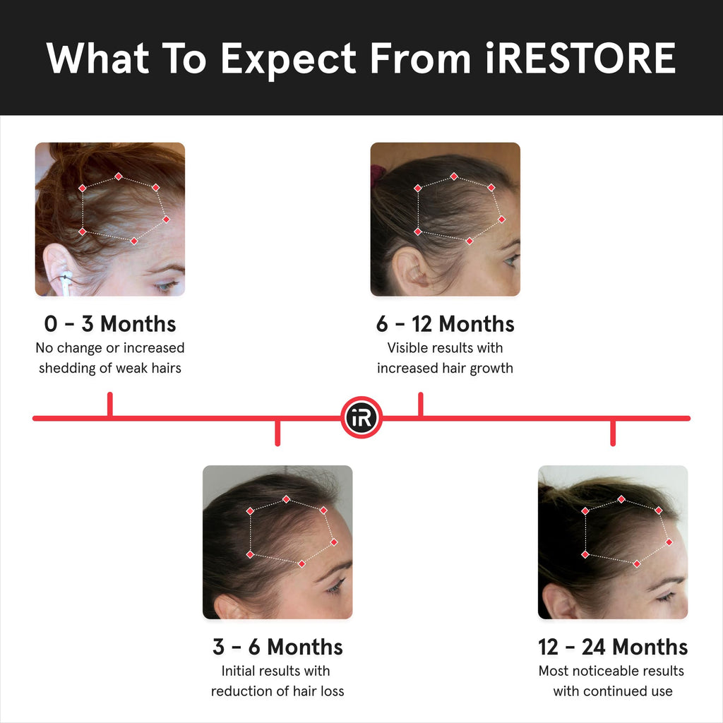 iRestore Essential Laser Hair Growth System + Rechargeable Battery Pack | FDA Cleared