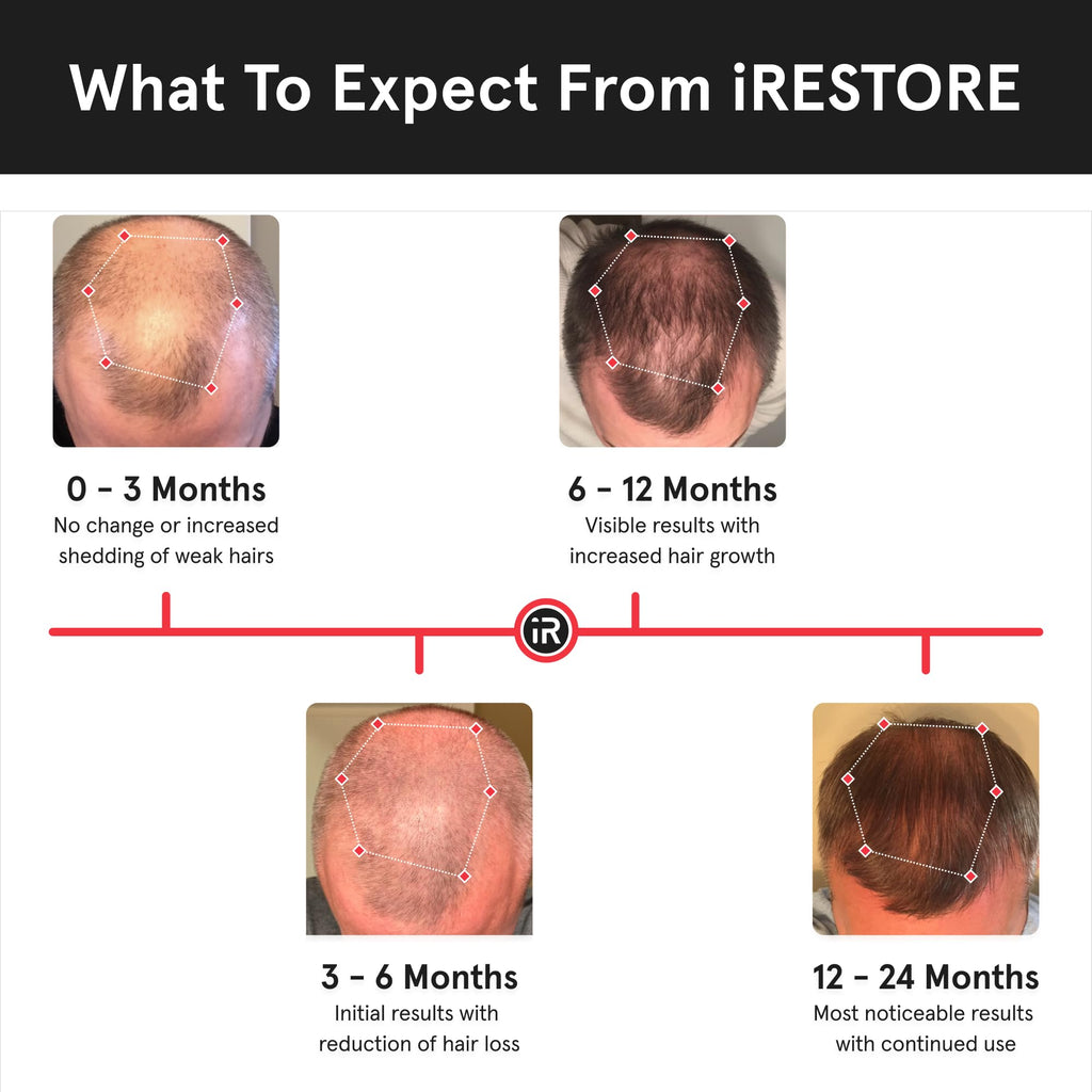 iRestore Essential Laser Hair Growth System – FDA-Cleared Hair Loss & Thinning Treatment for Men & Women