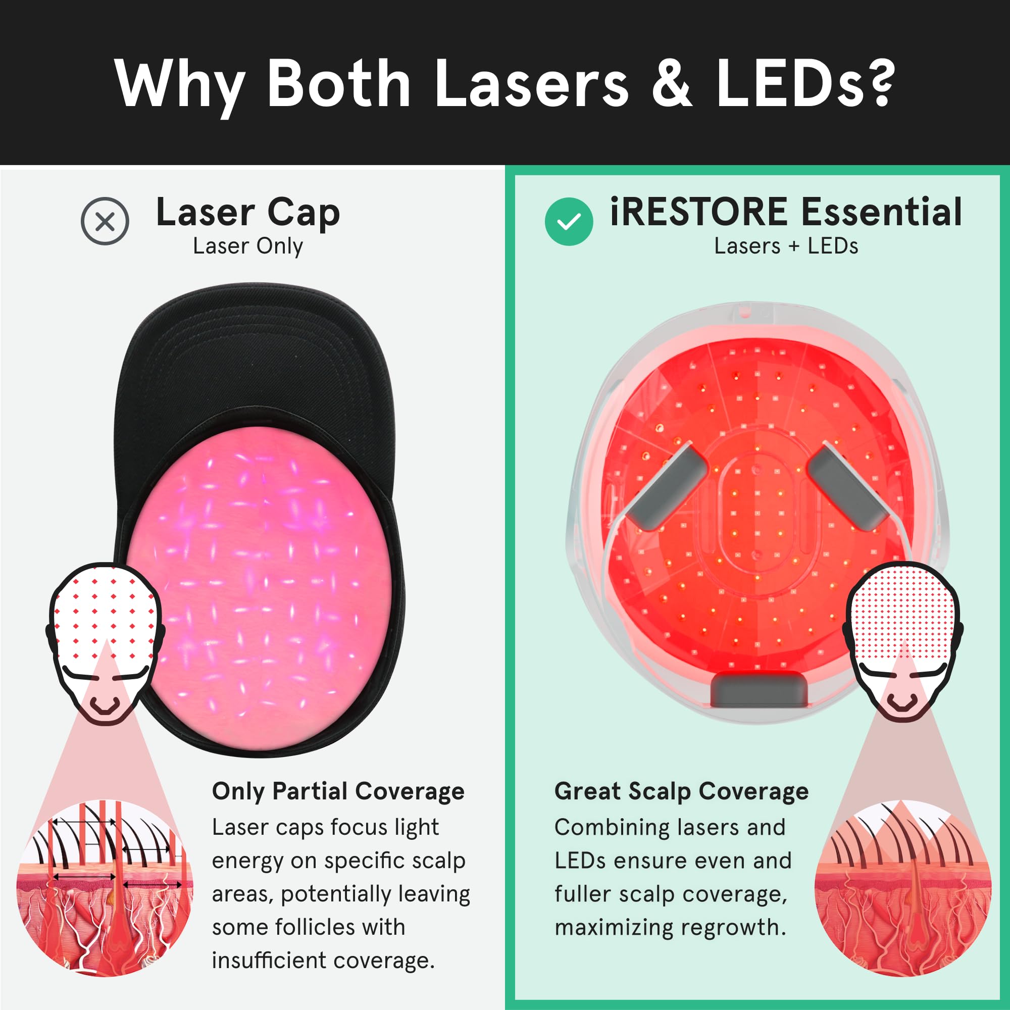 iRestore Essential Laser Hair Growth System – FDA-Cleared Hair Loss & Thinning Treatment for Men & Women