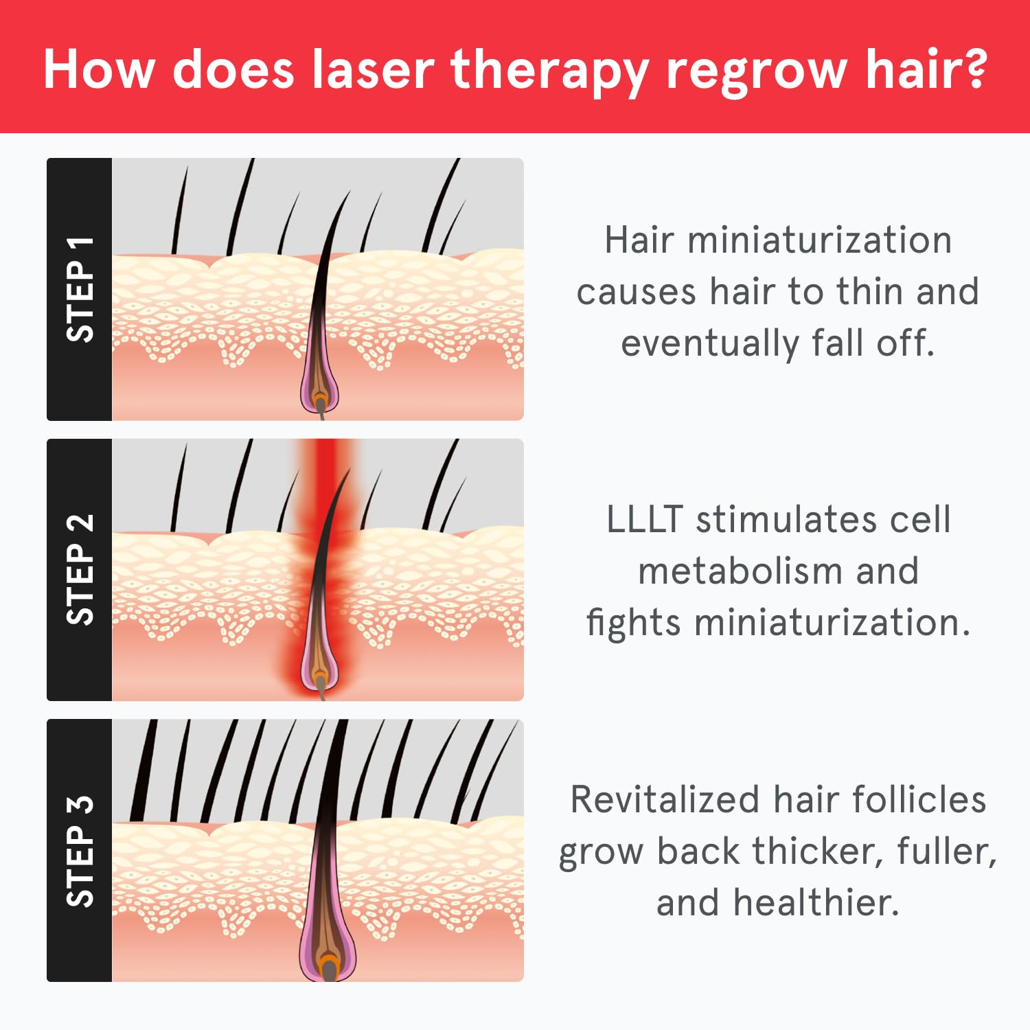 iRestore Essential Laser Hair Growth System – FDA-Cleared Hair Loss & Thinning Treatment for Men & Women