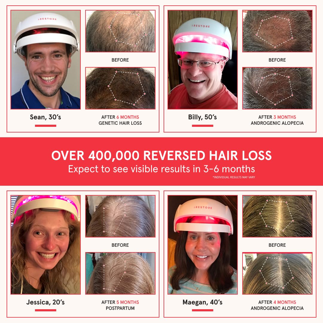 iRestore Essential Laser Hair Growth System + Rechargeable Battery Pack | FDA Cleared
