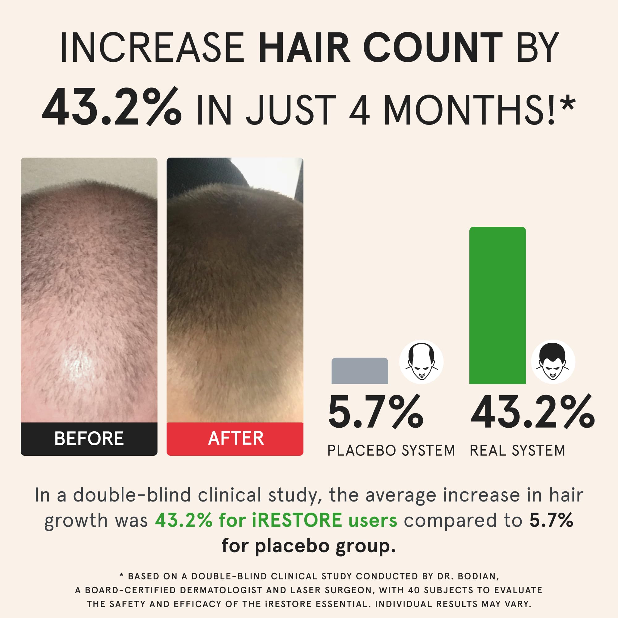 iRestore Essential Laser Hair Growth System + Rechargeable Battery Pack | FDA Cleared