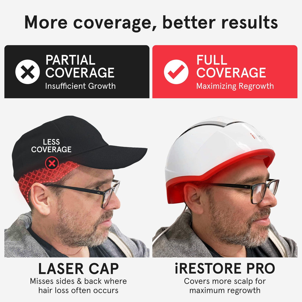 iRestore Pro + Rechargeable Battery Pack – 282 Lasers & LEDs Red Light Therapy for Hair Growth (FDA Cleared)