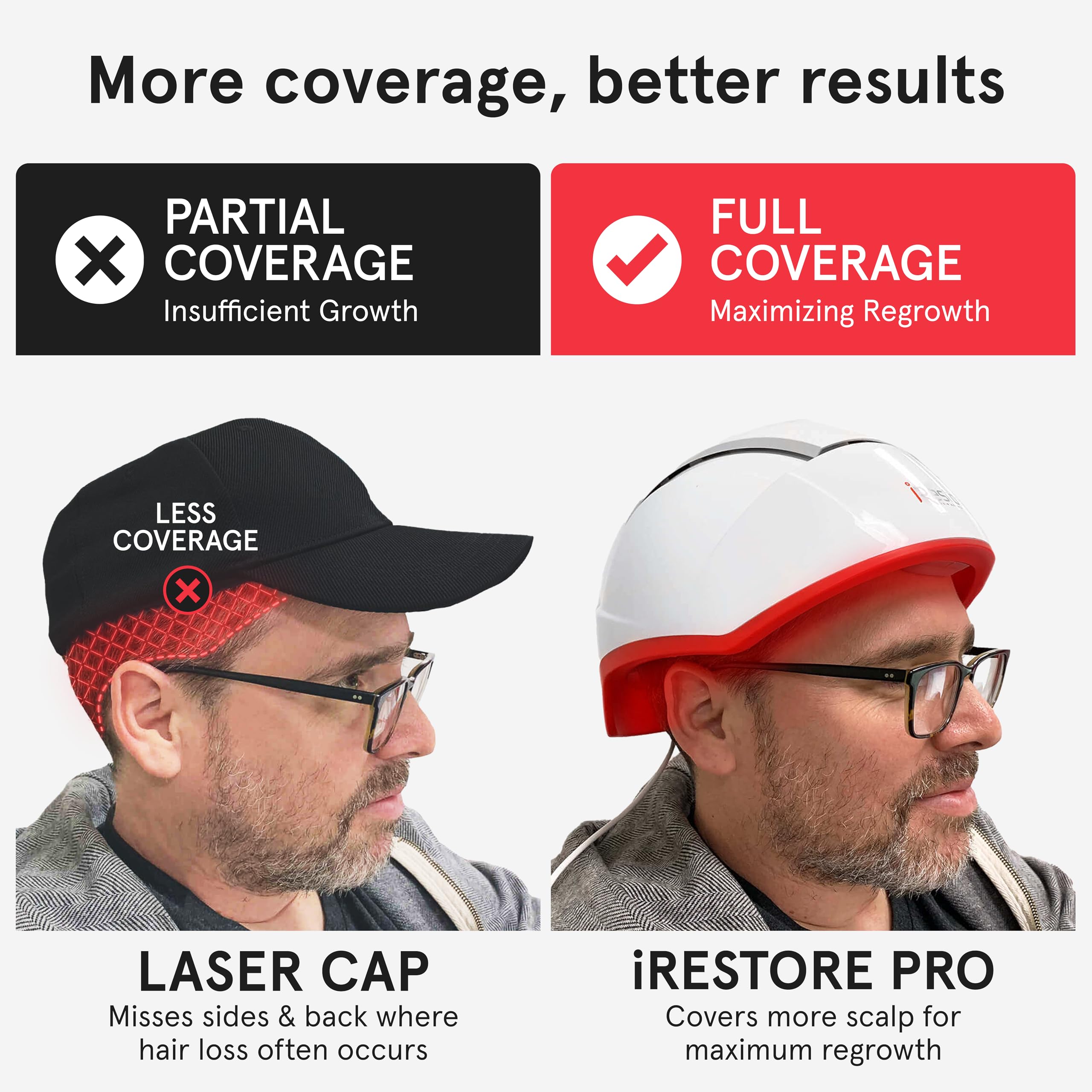 iRestore Pro: 282 Lasers & LEDs Hair Growth System | FDA Cleared