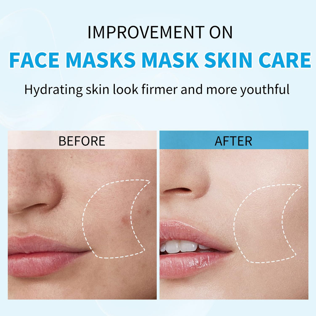 IREV Hyaluronic Acid Face Mask | Hydrating Sheet Mask for All Skin Types (Pack of 10)