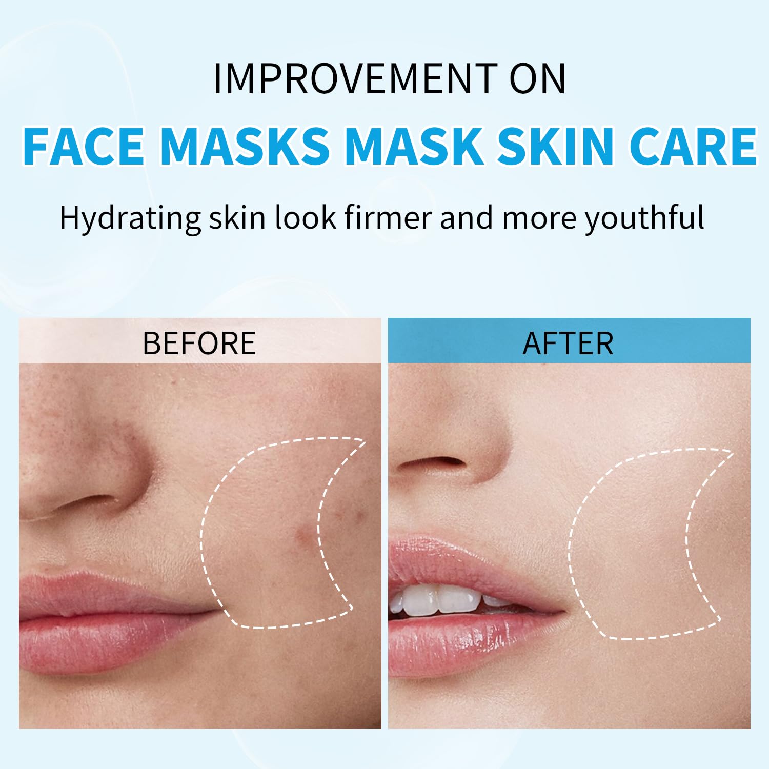 IREV Hyaluronic Acid Face Mask | Hydrating Sheet Mask for All Skin Types (Pack of 10)