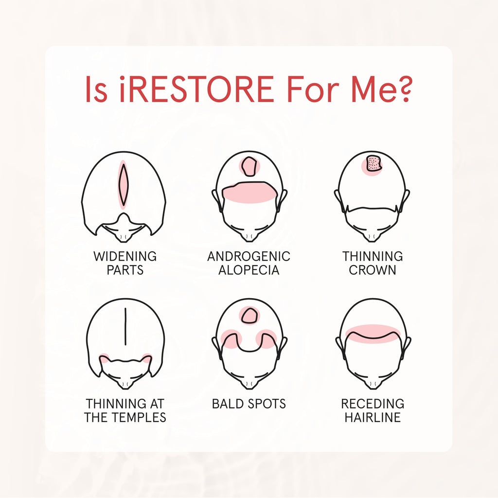 iRestore Anti Hair Loss Shampoo with Biotin – Growth, Thickening & Volumizing for Men & Women